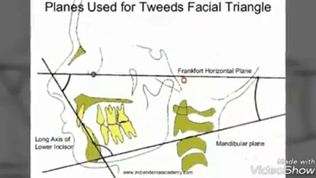 Cephalometrics in Orthodontics (14.3) by Dr. Ronny Aung смотреть онлайн