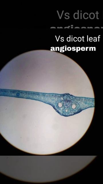 Slide of Vertical Section (V.S) of Dicot Leaf Angiosperm смотреть онлайн