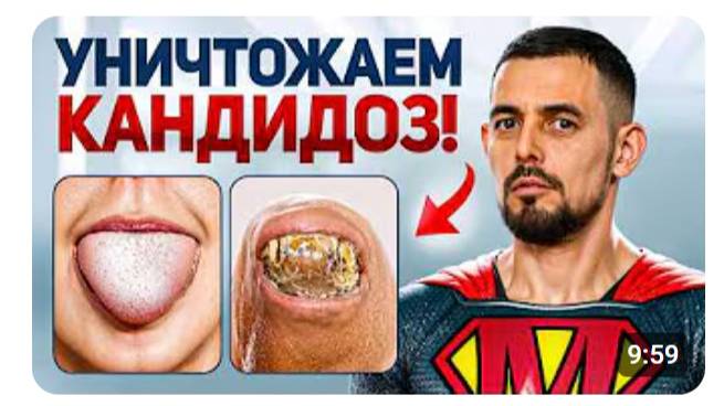 Как лечить КАНДИДОЗ? Кандида боится ЭТОГО смотреть онлайн
