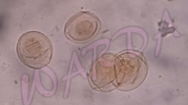 Cestoda Slides for Medical Students смотреть онлайн