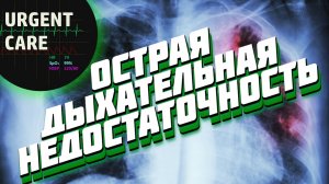 Острая дыхательная недостаточность. Лекция