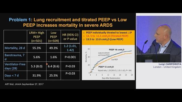 Ventilator Induced Lung Injury Luigi Camporota 2022