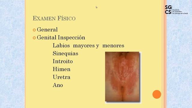 Dra. Margarita Fuster - Patología mas frecuente en Ginecología Infanto-juvenil смотреть онлайн