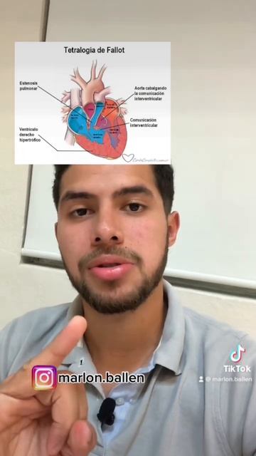 #medicine #cardiology #medicina #estudiantedemedicina смотреть онлайн