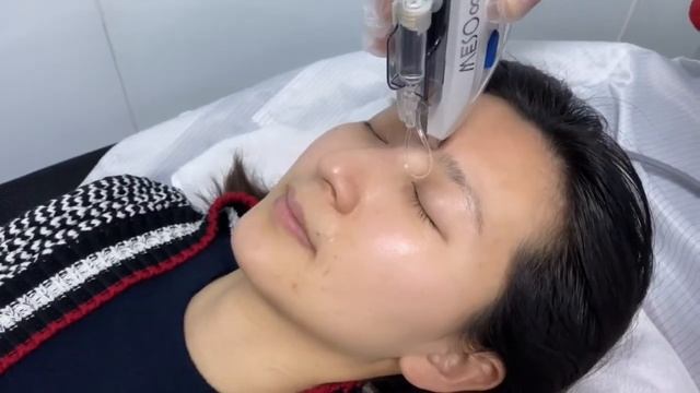 MESO∞™ （MESO infinity）ETM Mesotherapy Device for skin care and scalp care смотреть онлайн