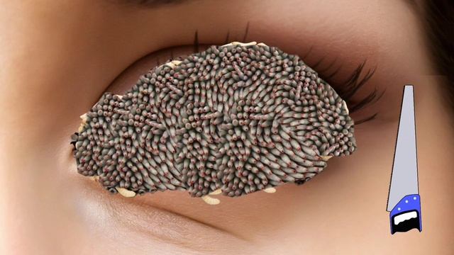 ASMR Animation Treatment Removal Cytes, Worm & dig tick from Infected The eyes 2d Deep Cleaning смотреть онлайн