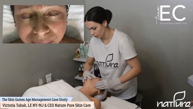 Victoria Tabak Treating Aging Skin in The Skin Games 2019 | Week 8 смотреть онлайн