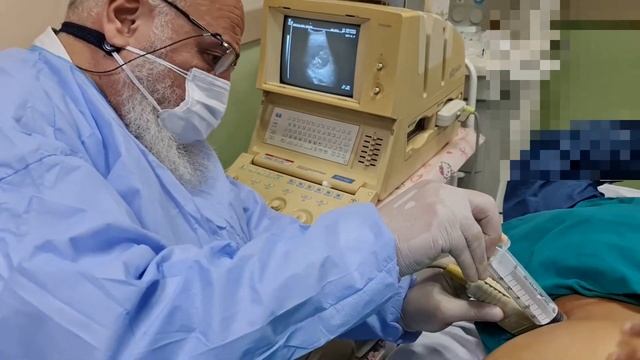 HYDATID CYST PAIR TECHNIQUE BY DR SAMY ZAKY смотреть онлайн