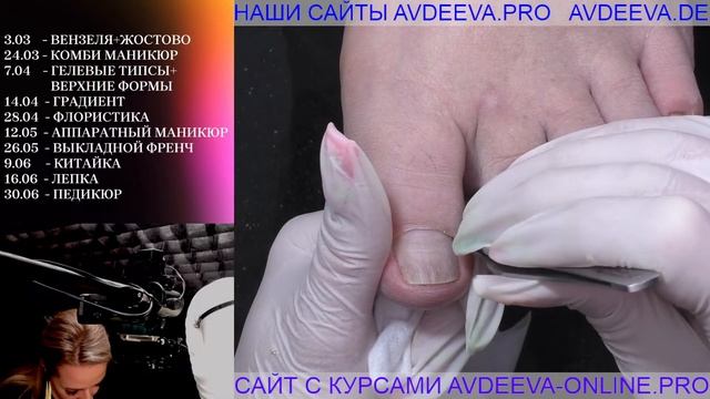 ПЕДИКЮР ОНЛАЙН. Виктория Авдеева смотреть онлайн