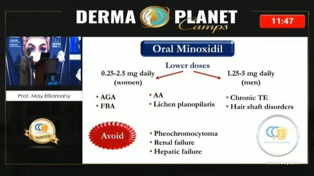 Hair loss ; challenges & innovations by Dr May El Samahy