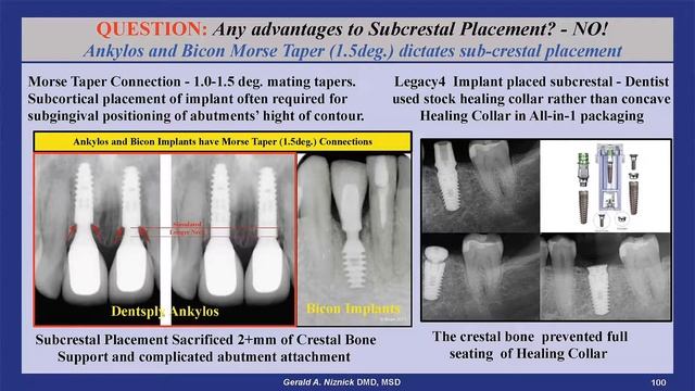 Are the obvious disadvatages of subcrestal placement justifed by any perceived advatages? смотреть онлайн