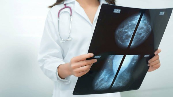 ПАМЯТКА - ВРАЧУ РЕНТГЕНОЛОГУ. МАММОГРАФИЯ. КУРС МАММОЛОГИИ 
+7985 9 245245 МУСТАФИН ЧИНГИС