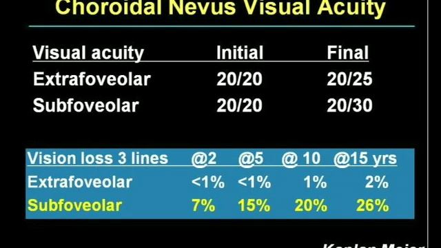 Long Term Followup of a Choroidal Nevi смотреть онлайн