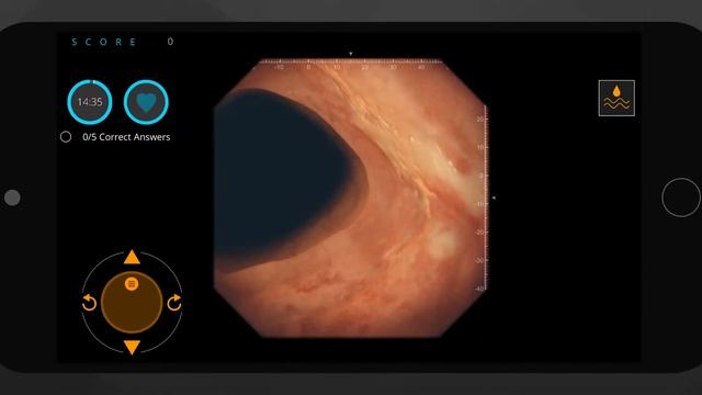 Gastro Ex Case: Crohn's Disease смотреть онлайн
