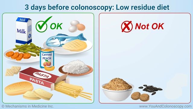 What is a colonoscopy and how do I prepare for it? смотреть онлайн