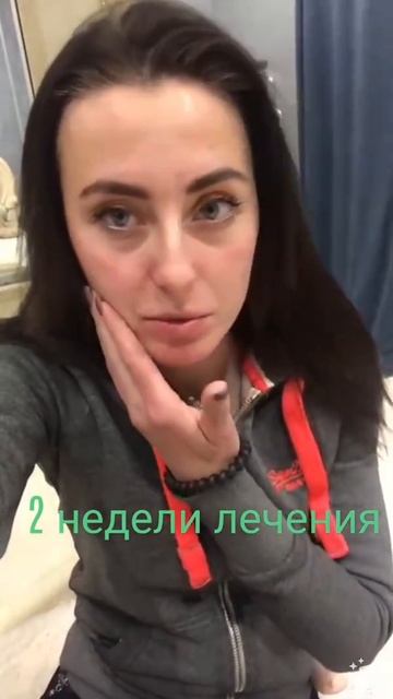Я вылечила кожу/ 2 недели лечения смотреть онлайн