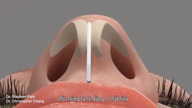 Hành Trình Lột Xác 2017 | Tập 4: Phương Tuyền - Lột xác để viết tiếp đam mê смотреть онлайн