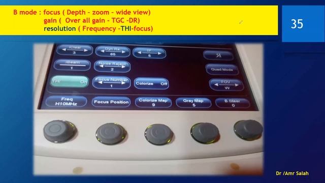 Doppler Course ( machine settings) , how to adjust your machine ...DR/ AMR SALAH د عمرو صلاح смотреть онлайн