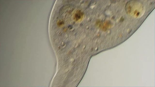 Microscopic World - Protozoa, Dileptus sp. смотреть онлайн