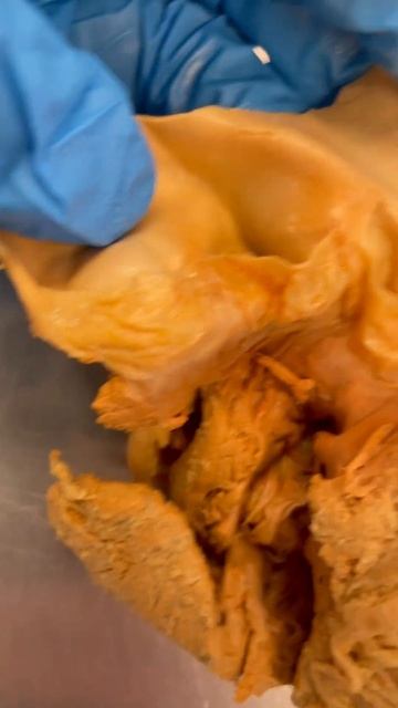 AMAZING Human Heart Valves! смотреть онлайн