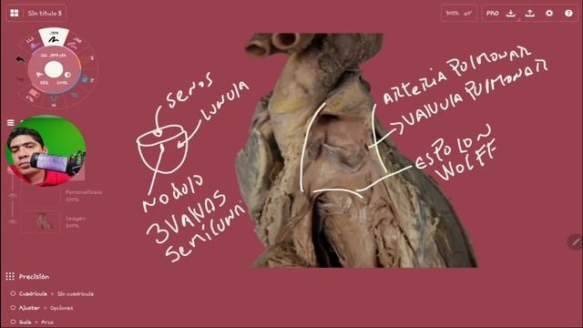 APRENDE FACIL : Anatomia de las cavidades cardiacas смотреть онлайн
