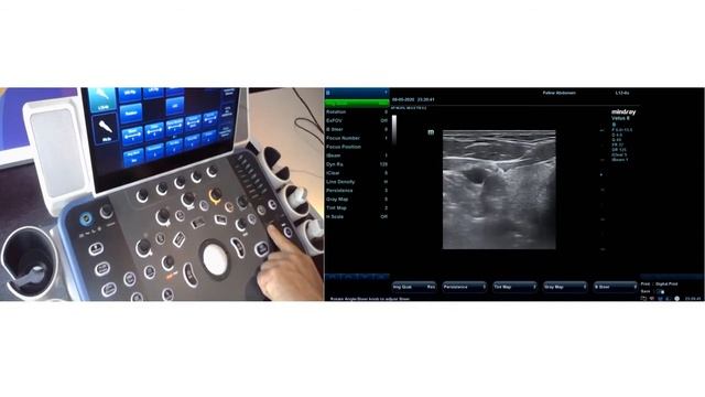 Mindray VETUS Frekwentie Diepte Gain Focus смотреть онлайн