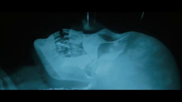 Росомахе вводят адамантий в скелет⁄ Люди Икс Начало Росомаха 2009 смотреть онлайн