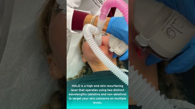 HALO® Laser Treatments Get That Glow with HALO смотреть онлайн