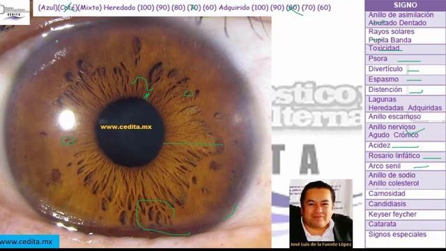0042 Diagnostico de signos Iridología смотреть онлайн