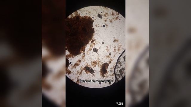 Treats Ear Infection, Fights Bacteria, Reduces Itching. смотреть онлайн