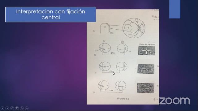 Evaluación del estado Sensorial II смотреть онлайн