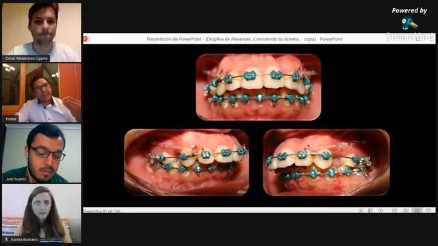Alexander Modificado Conociendo el Sistema - Prof. Huber Claros смотреть онлайн