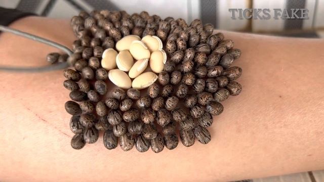 What do we need to do when removing ticks смотреть онлайн