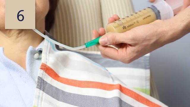 Como alimentar uma pessoa por sonda смотреть онлайн