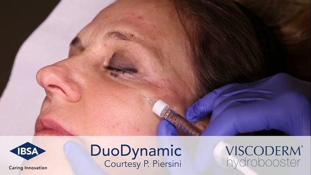 Viscoderm Hydrobooster - DuoDynamic Technique Periocular Area