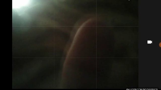 Мой брат дебил смотреть онлайн