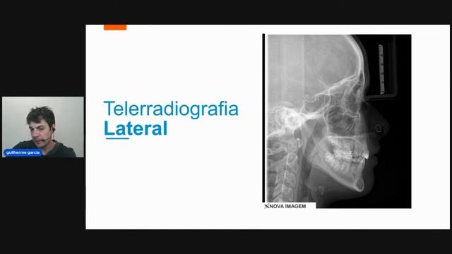 Aula 2 - Aplicações Clínicas Avançadas: Técnicas de intrusão posterior unilateral смотреть онлайн