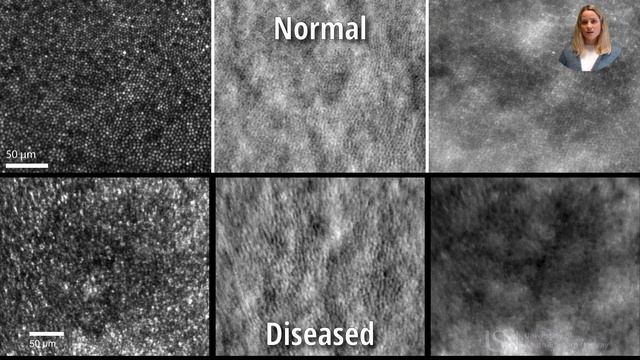 NEURON2020_AID-Artificial intelligence for diagnosing retinal diseases смотреть онлайн