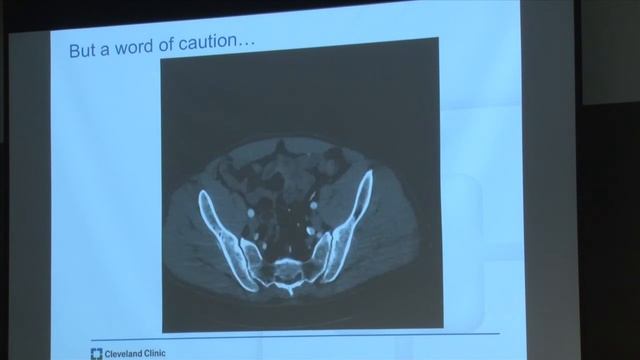 2017 Stanford Aortic Festgraft (Part 4): Lessons Learned and Unmet Needs & Future Developments смотреть онлайн