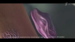 Реклама Венарус - «Ящерица» 1