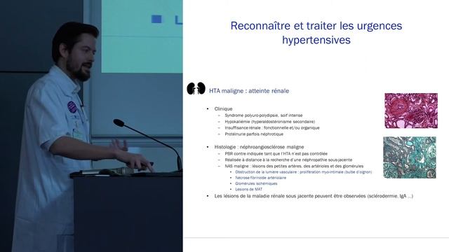 05 Reconnaître et traiter les urgences hypertensives hors AVC смотреть онлайн