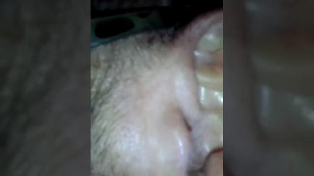 More hate with grave lice. This lice was will ravage the body. смотреть онлайн