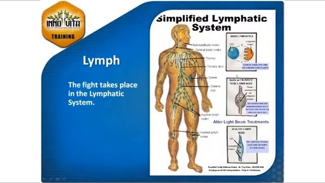 Triangle of Health, Treating Layers of Infection, Rehabilitation, Kinesiology смотреть онлайн