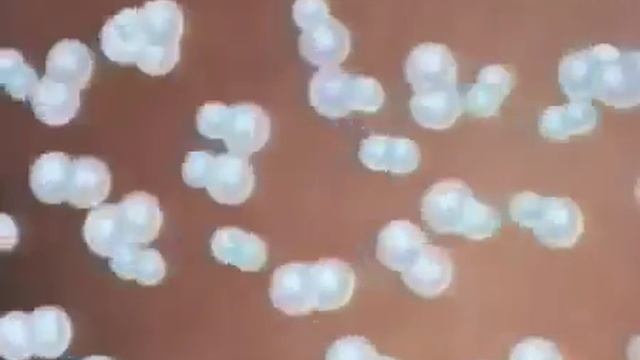 Скорость химических реакции смотреть онлайн