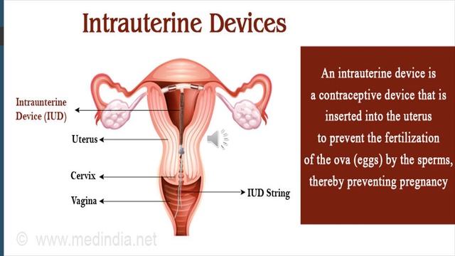 Lecture of Dr. Aneeqa for MBBS 4th Year on Topic Family Planning-Part-I смотреть онлайн