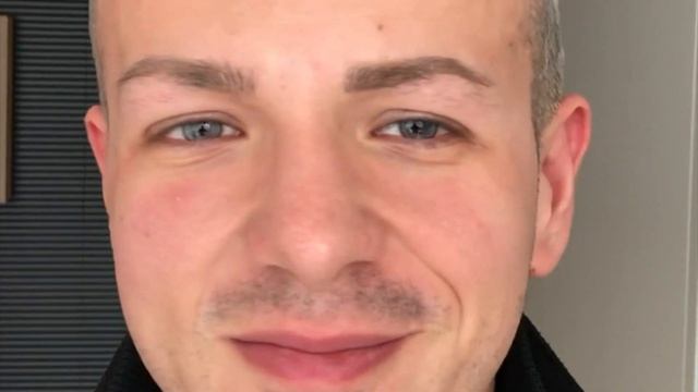 Changing Eye Color WITHOUT implant, with the NEORIS technique: Aqua Color смотреть онлайн