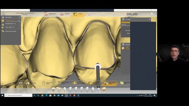 CEREC-InLAB-Meshmixer workflow | Dentistry Web Class смотреть онлайн