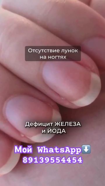 Дефициты в организме. Витамины и минералы. О чем кричит ваш организм. Мой ватсап ➡️89139554454 смотреть онлайн
