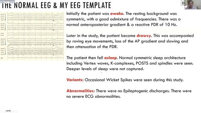 FINE Evening - EEG Series - Dr Neeraj Baheti & Dr Siddharth Kharkar - 15 April 2020 смотреть онлайн