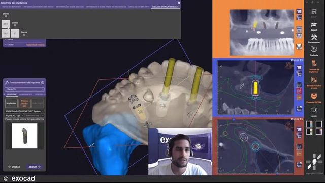 exocad exoplan 2021 WEBINAR - exoplan 3.0 Galway Cirurgia guiada (PT) смотреть онлайн